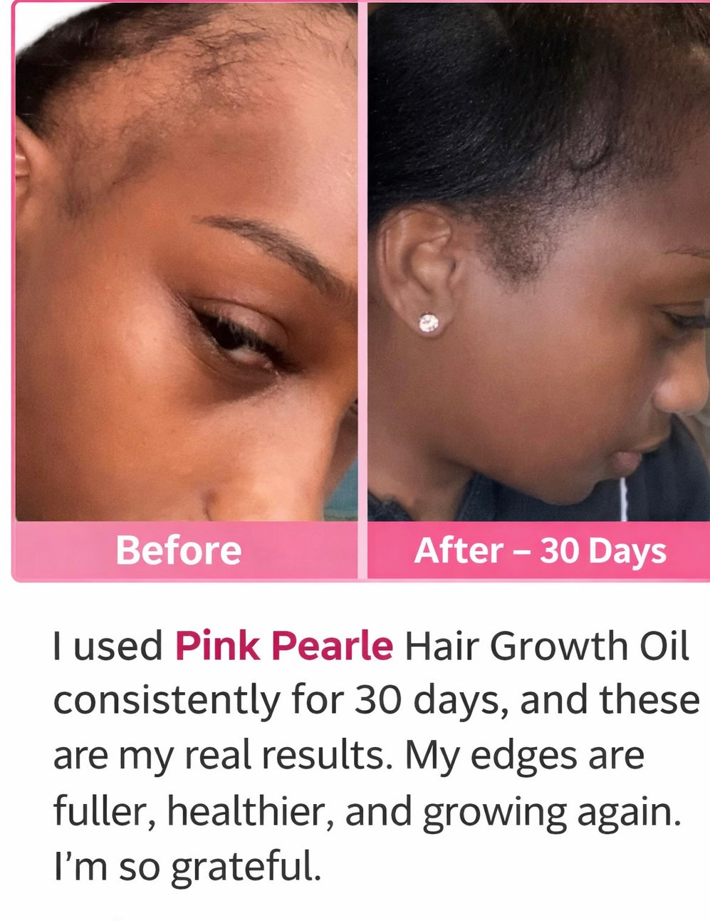 PINK PEARLE HAIR ESSENTIAL GROWTH OIL